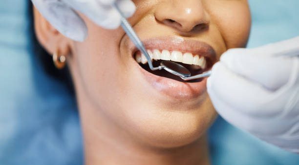 Best Pediatric Emergency Dentist in Pleasant Hill, TX