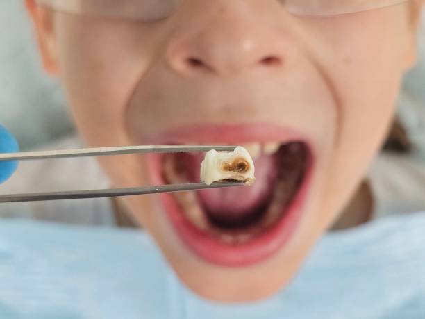 Best Emergency Dentist for Special Needs Patients in Pleasant Hill, TX